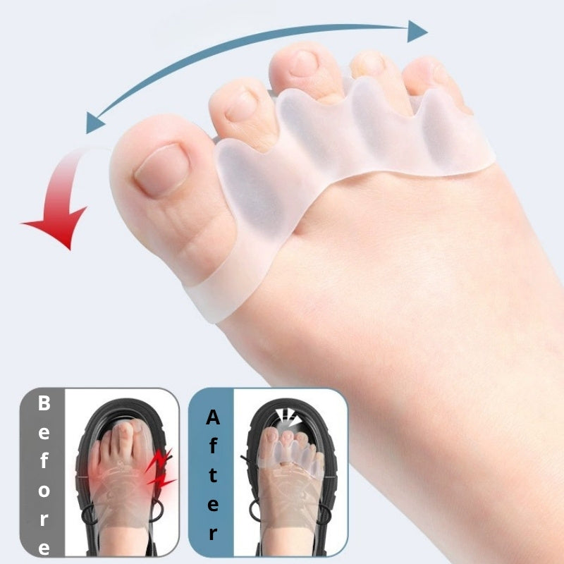 Toe Separator